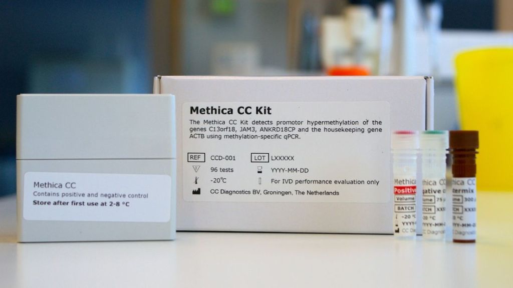 Nieuwe Groningse test voorkomt duizenden fouten bij opsporen baarmoederhalskanker